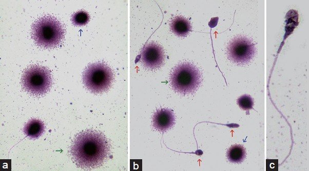 DNA fragmentation index