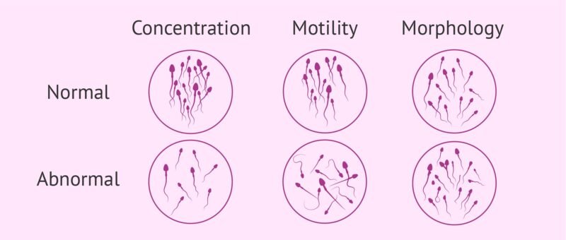 semen analysis